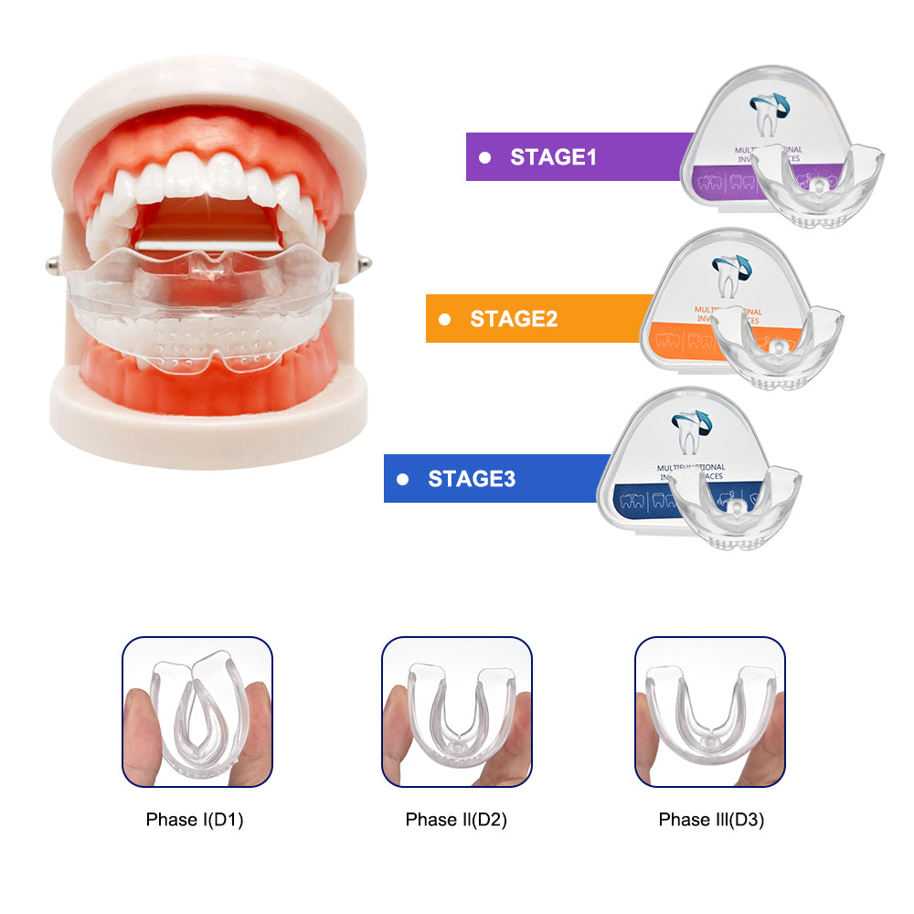 Attelle pour une correction physique de la dentition