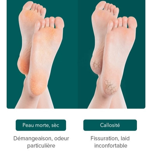 Lime pour avoir des pieds doux