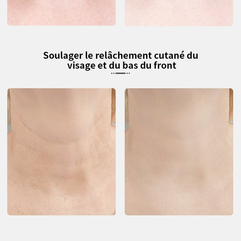 Appareil de beauté pour le soin du cou